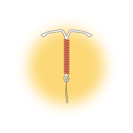 IUD（子宮内避妊具）